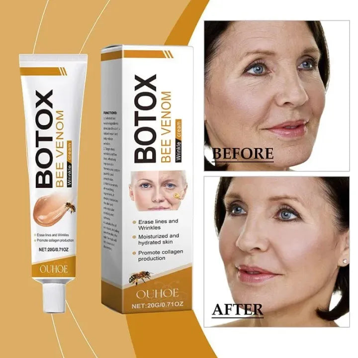 CREMA DE BOTOX VENENO DE ABEJA